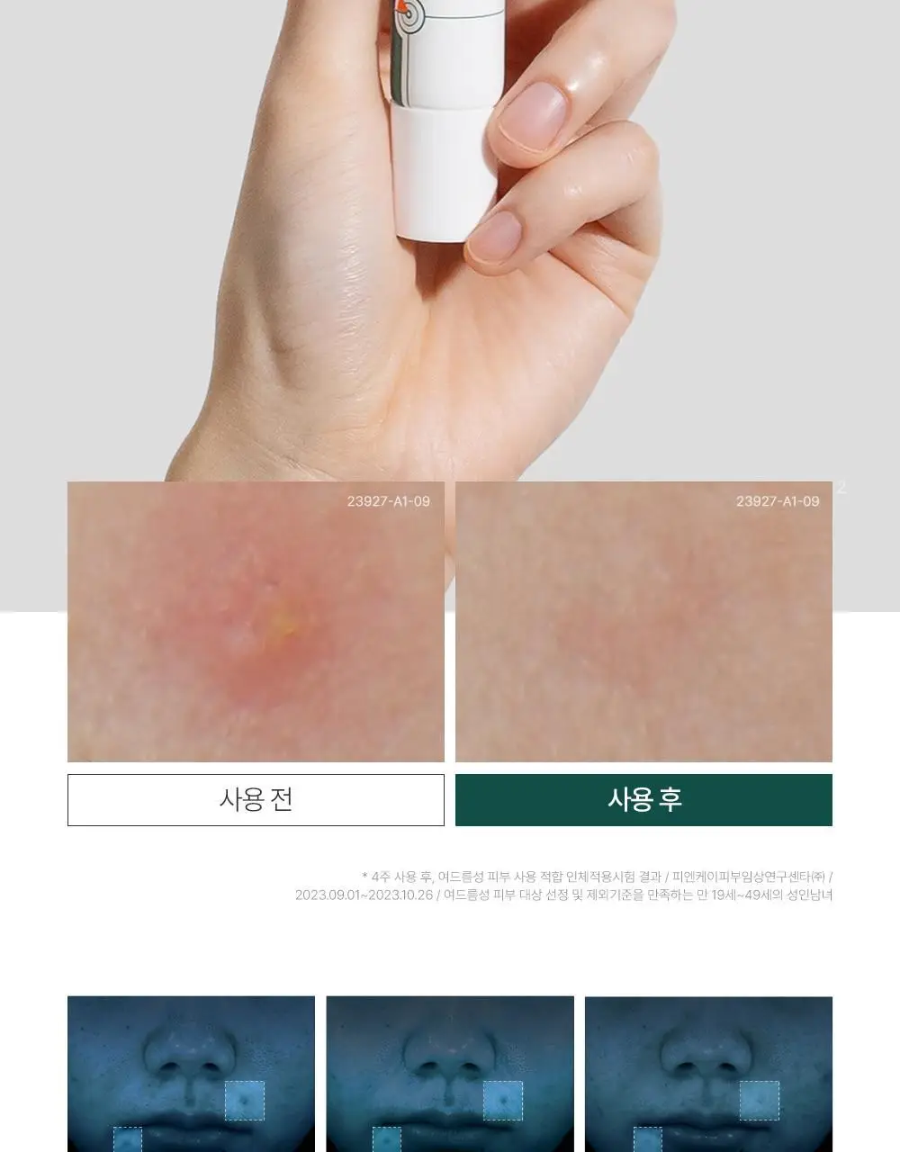 [트러블부위 진정케어] 피캄 센텔라 트러블 스팟 15ml 상세페이지 2
